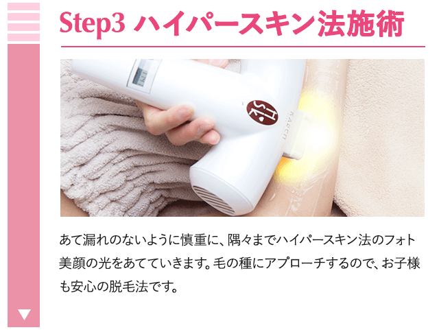 ハイパースキン法施術